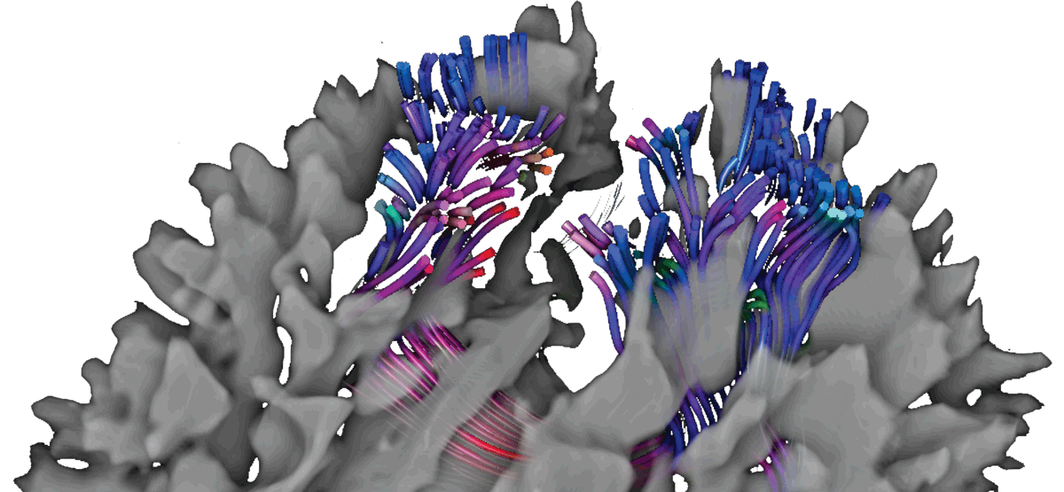 Combined Surface and Volumetric Occlusion Shading teaser image