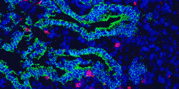 Innate Lymphoid Differentiation screenshot