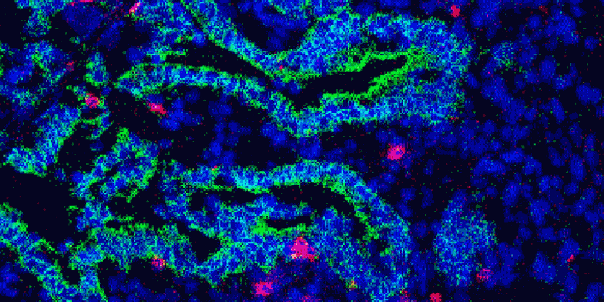 Memory CD4+ T Cells are Generated in the Human Fetal Intestine teaser image