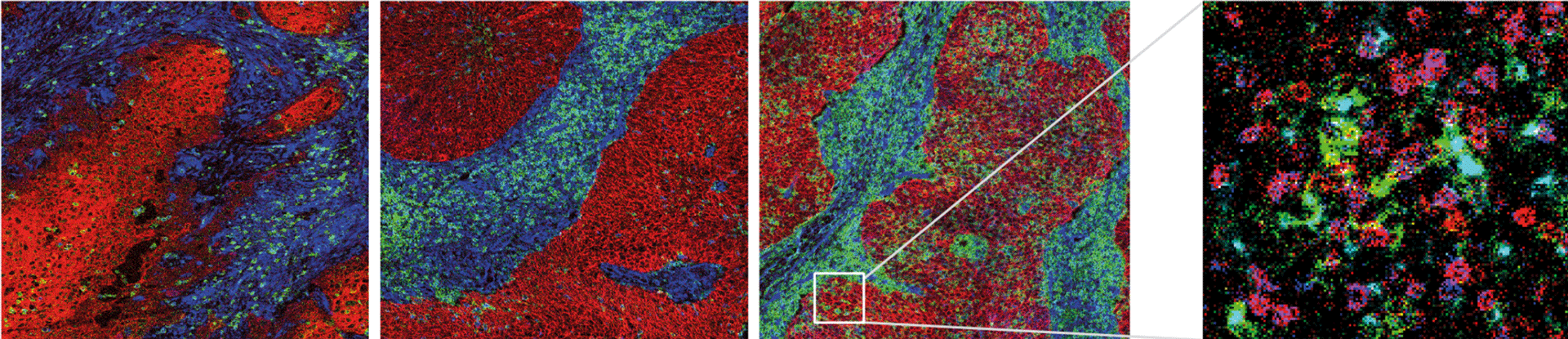 Tumor-specific T cells support chemokine-driven spatial organization of intratumoral immune microaggregates needed for long survival teaser image